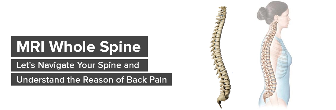 MRI Whole Spine- Let's Navigate Your Spine and Understand the Reason of Back Pain